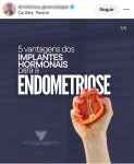 implantes-hormonais-que-pegam-carona-nos-‘chips-da-beleza’-eram-feitos-em-farmacia-e-vendidos-como-tratamento,-mesmo-sem-comprovacao