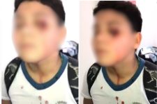 menino-e-agredido-com-soco-por-aluno-apos-sofrer-bullying-em-escola:-‘autista-balofo’;-video