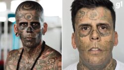 ‘mais-tatuado-do-brasil’-passa-por-3a-sessao-de-remocao-de-tatuagens-no-rosto;-veja-antes-e-depois