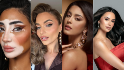 miss-universo-tem-pela-1a-vez-mulher-com-vitiligo,-modelo-surda-e-candidatas-com-mais-de-28-anos